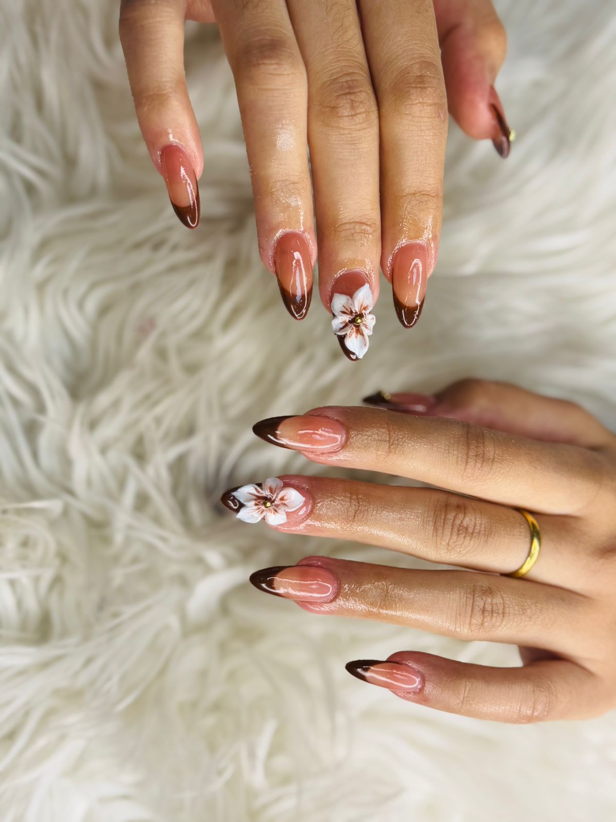 Toe Extension Removal